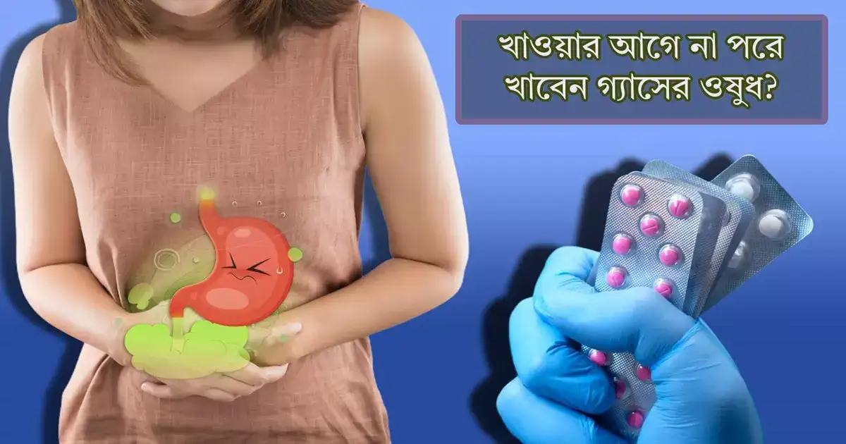 Fact Check খাওয়ার আগে না পরে খাওয়া উচিত গ্যাসের ওষুধ? চিকিৎসকের কথা
