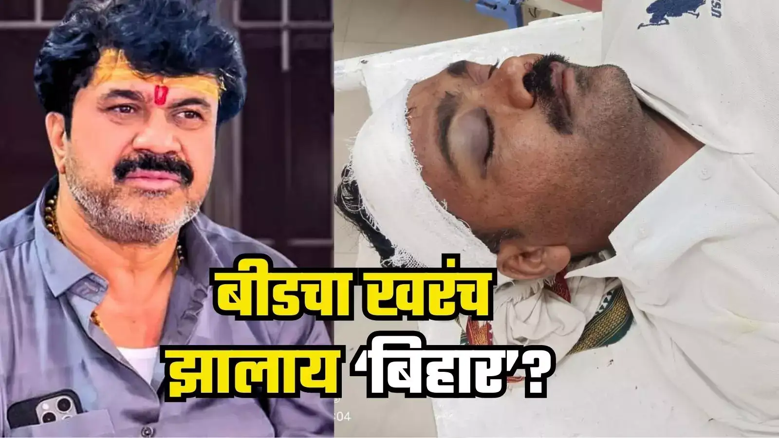 बीड पुन्हा हादरलं! तुझाही देशमुख करू म्हणत आंधळेच्या पोरांकडून होमगार्डवर कोयत्याने वार, डोक्याला 8 टाके, कारण काय? बीड पुन्हा हादरलं! तुझाही देशमुख करू म्हणत आंधळेच्या पोरांकडून होमगार्डवर कोयत्याने वार, डोक्याला 8 टाके, कारण काय?