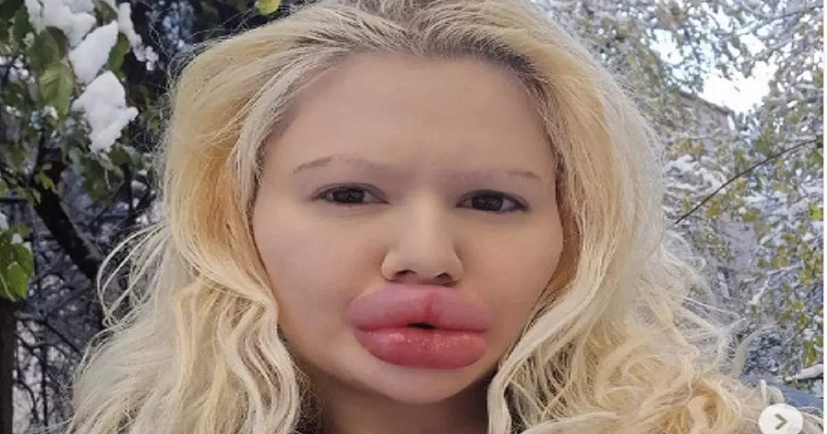 The World’s Thickest Lips Girlfriend: A New Adventure From Britain’s Andrea For 2024!