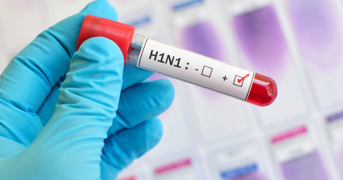 स्वाइन फ़्लू (H1N1 Virus)