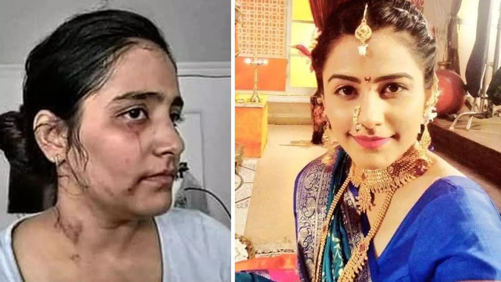 इस एक्ट्रेस पर शादी के बाद धर्म बदलने का दबाव बना रहा था मुस्लिम पति, पीटकर  कर दिया अधमरा, PMO से मांगी थी मदद - this actress accused husband of  forcing her