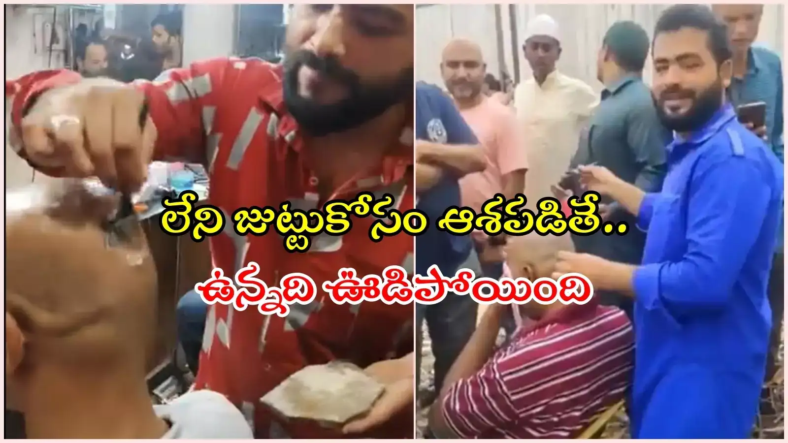 బట్టతలపై జుట్టు అనగానే టెంప్టయ్యారు.. ఆ తర్వాత హాస్పిటల్స్‌కు క్యూ కట్టారు, ఎంత పనైపాయే..!