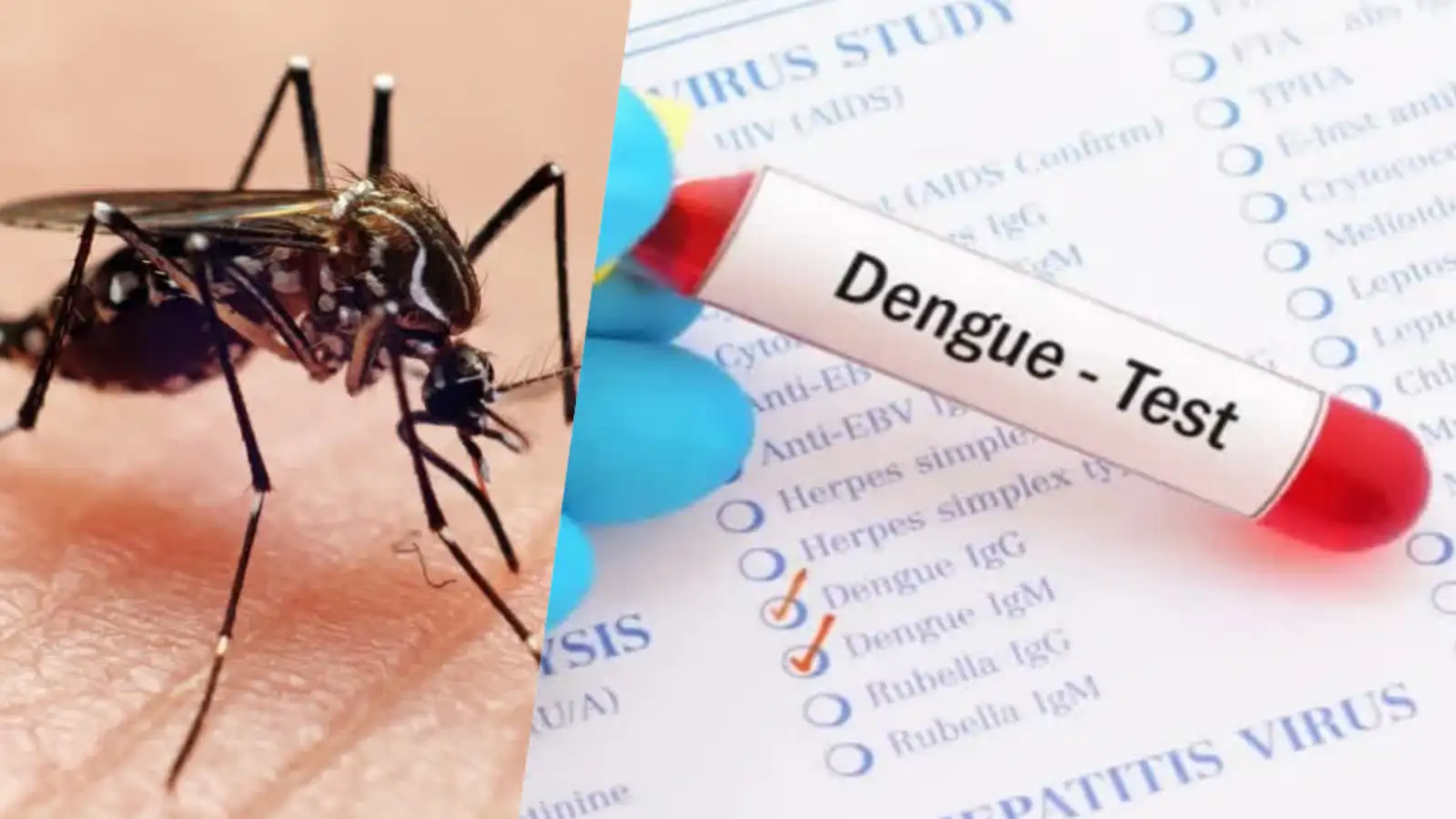 சென்னையில் 5 பேருக்கு டெங்கு காய்ச்சல் உறுதி - பொதுமக்களுக்கு எச்சரிக்கை! 