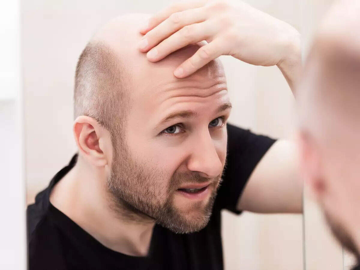 How to Control Hair Fall After Delivery? Postpartum Hair Loss Remedies |  MyloFamily