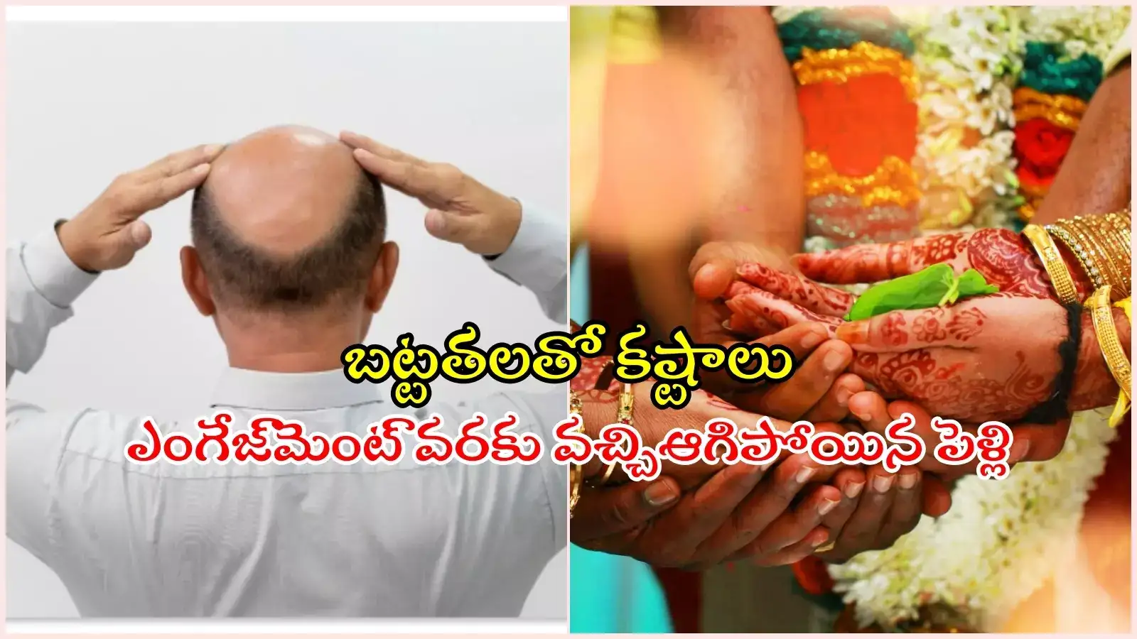 HYD: బట్టతల ఉందని పెళ్లి క్యాన్సిల్ చేసిన యువతి... సూసైడ్ చేసుకున్న యువ డాక్టర్