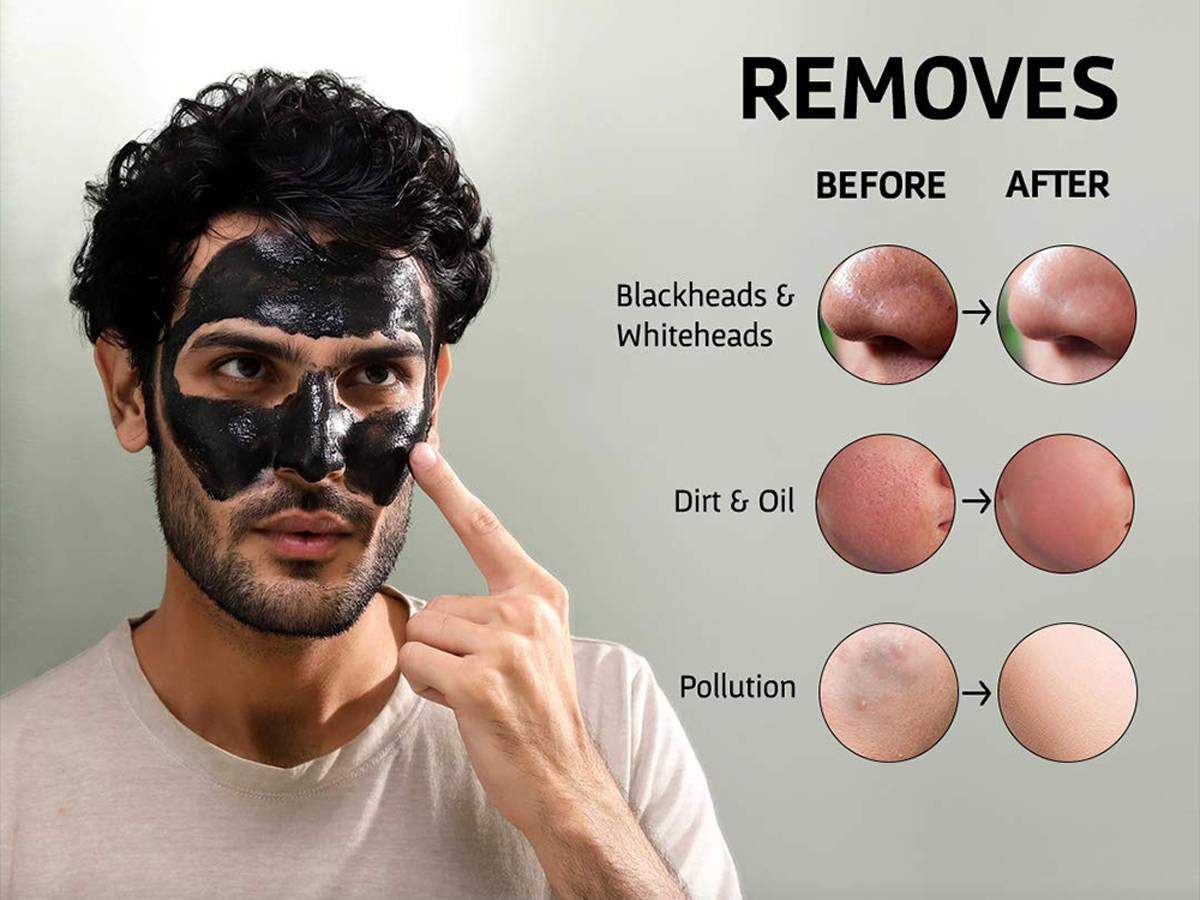 charcoal face mask use in hindi