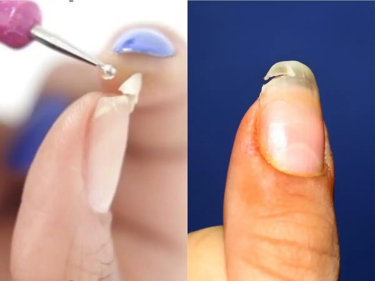 Discover 169+ nail set kaise kare super hot songngunhatanh.edu.vn