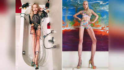 Lengthening Legs Surgery: लड़की ने टांगों की लंबाई बढ़ाने के लिए करवाई दर्दनाक सर्जरी, अब हाइट हो गई है इतने फीट