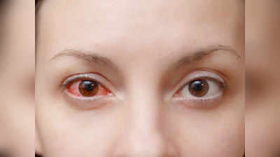 Covid Symptoms In Eye: কোভিডের ফাঁদে পড়তে পারে চক্ষুযুগলও! লক্ষণ জেনে ব্যবস্থা না নিলে বিপদ