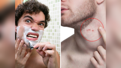 दाढी केल्यानंतर त्वचेची आग होतेय? मग हे घरगुती उपाय करून पाहा