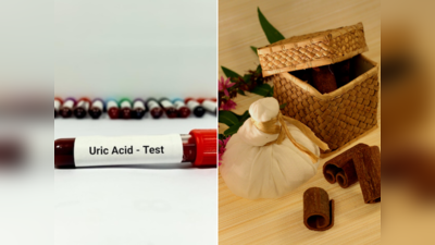 Uric Acid & Ayurveda: ના દવા- ના ડોક્ટર, હાઇ યુરિક એસિડનો રામબાણ ઇલાજ છે આ 5 આયુર્વેદિક જડીબુટ્ટી; કરો કાયમી ઇલાજ