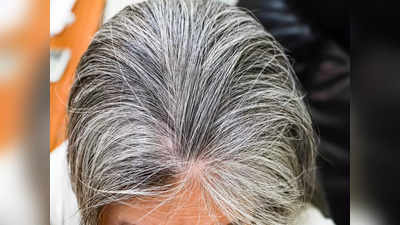 Premature Hair Graying: ৩০-এর আগেই মাথা ভরেছে সাদা চুলে? কালো চুল ফিরে পেতে কী করবেন আর কী কী করবেন না