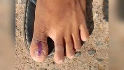 Karnataka Elections 2023 : ವ್ಯಕ್ತಿಯೊಬ್ಬರ ಕಾಲಿನ ಬೆರಳಿಗೆ ಶಾಹಿ ಹಾಕಿದ ಚುನಾವಣಾ ಸಿಬ್ಬಂದಿ!