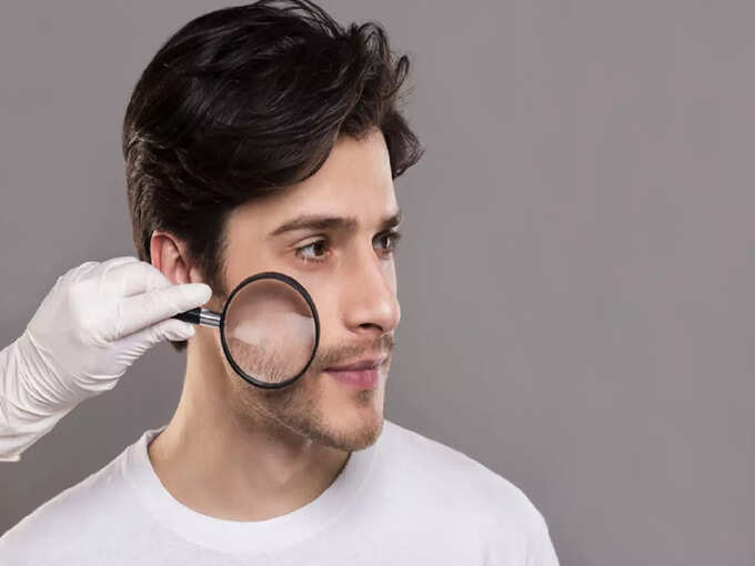 Can birthmarks cause skin cancer? Recognize by these 5 symptoms | Hits Times the color