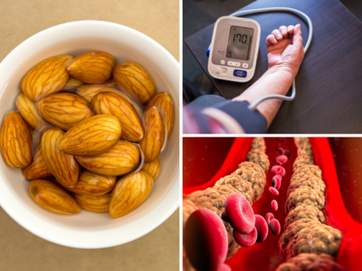 World Hypertension Day 2023: कोलेस्ट्रॉल भी है High BP की जड़, नसों से Bad Cholesterol खींच निकालेंगे डॉ. के 3 उपाय