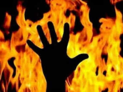 Kanpur News: फूफा ने भतीजे पर पेट्रोल डालकर लगाई आग, बचाने में झुलसीं महिलाएं, हालत गंभीर