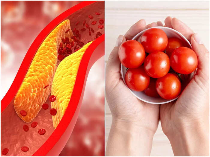 Unclog Arteries: Do you know, if you keep any 5 foods in your daily diet, the dirt will be cleared and the clogged arteries will be opened? Unclog Arteries: Do you know, if you keep any 5 foods in your daily diet, the dirt will be cleared and the clogged arteries will be opened?