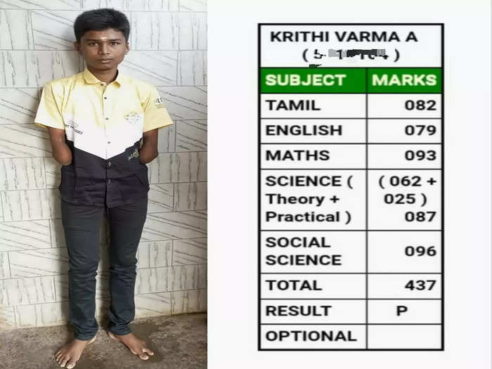 Krishnagiri physically disable student school first