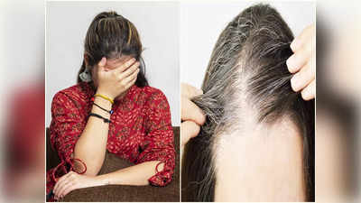 Premature Hair Graying: দুশ্চিন্তা করলে কি অল্প বয়সেই মাথা ভরে যায় পাকা চুলে? সত্যিটা শুনুন চিকিৎসকের মুখে