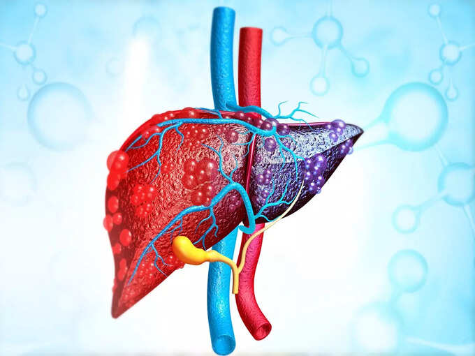 1. Get rid of liver problems 1. Get rid of liver problems