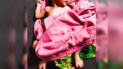 Jalgaon News: वैद्यकीय इतिहासातील दुर्मिळ घटना! २६ बोटांच्या बाळाचा जन्म, जळगावात चर्चाच चर्चा