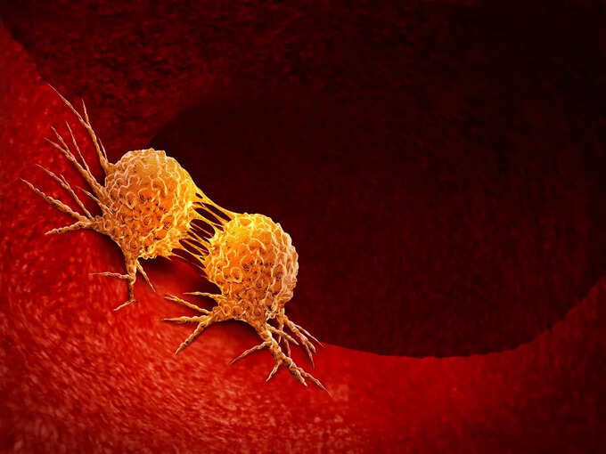 Siddhahast to prevent cancer