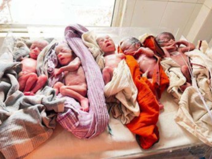 Quintuplets delivery in ranchi