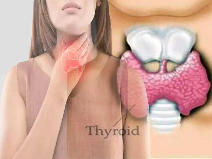 ​தைராய்டு இருந்தால் goiter பிரச்சனை வருமா?​