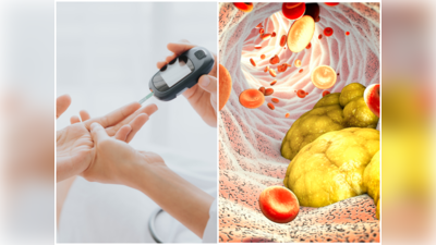 Diabetes and Cholesterol: ಶುಗರ್‌ ಹಾಗೂ ಕೊಲೆಸ್ಟ್ರಾಲ್‌ 200 ದಾಟಿದ್ಯಾ? ಹಾಗಾದ್ರೆ ಇವುಗಳಿಂದ ಕಂಟ್ರೋಲ್‌ಗೆ ತರಬಹುದಂತೆ