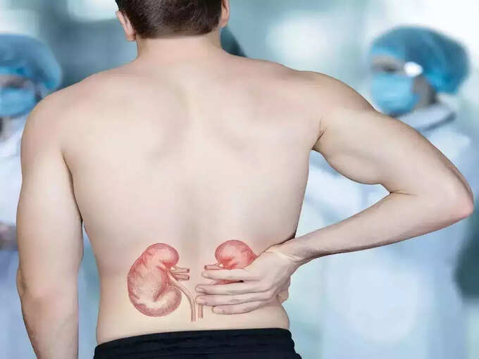 home remedies for kidney stones