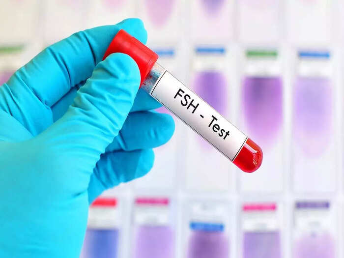 What Is A Normal Fsh Level To Get Pregnant what-is-a-normal-fsh-level-to-get-pregnant