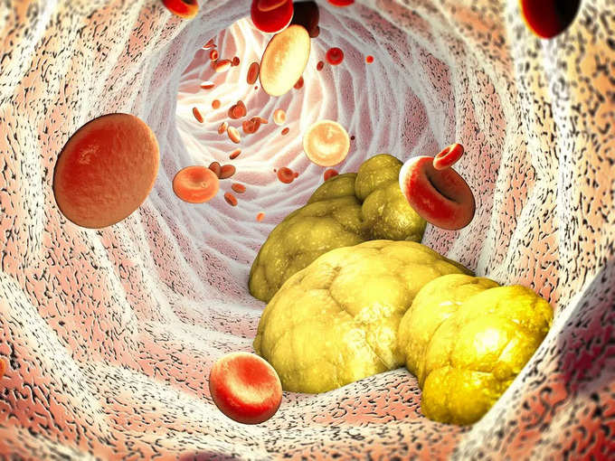 Cholesterol patients got tremendous benefit
