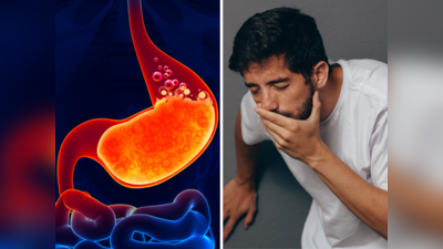 पेट में बन रहा भयंकर तेजाब, खट्टी डकारों ने कर दिया दुखी? Acid Reflux को तुरंत खत्म करेंगे Dr. के देसी 6 उपाय