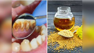 Teeth Whitening Home Remedies: दांतों की पीली परत होगी साफ, मोती जैसी चमकेगी बत्तीसी, तुरंत ले आएं ये 4 चीजें