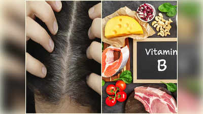 Vitamins For Gray Hair: ৫ ভিটামিনের অভাবে ৩০ বছরেই মাথা ভরে যায় পাকা চুলে, জানুন কোন খাবারে মিটবে ঘাটতি