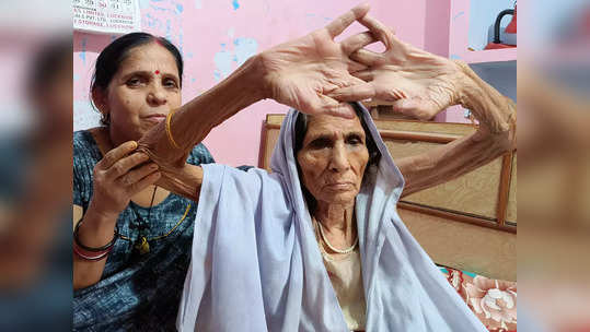 Yoga Day: 88 साल की महिला ने योग से दे दी कैंसर को मात, 25 साल पहले डॉक्टरों ने खड़े कर दिए थे हाथ
