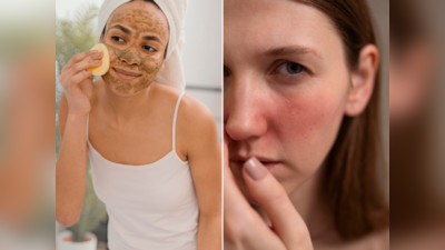 Harmful Beauty Remedies: ત્વચાને ગ્લોઇંગ નહીં, ડાઘ-ધબ્બાથી ભરપૂર બનાવશે આ ઘરેલૂ નુસખાઓ; ડર્મેટોલોજીસ્ટની સલાહ