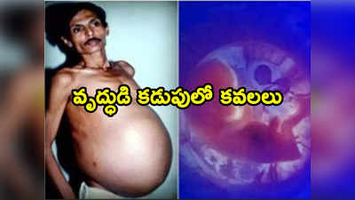 Man pregnant: 60 ఏళ్ల వృద్ధుడు ప్రెగ్నెంట్.. కడుపులో ఇద్దరు.. అదే కారణమా ?