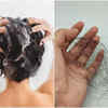 Do antidandruff shampoos cause hair loss  Regrowz