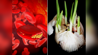 Garlic Benefits: અઠવાડિયામાં એકવાર કાચું લસણ ખાવાથી નસોમાં જમા કોલેસ્ટ્રોલ થઇ જશે દૂર; લોહી રહેશે શુદ્ધ