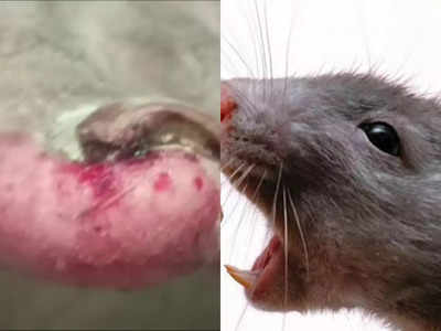Jodhpur News: MDM अस्पताल में भर्ती मरीजों को शिकार बना रहे चूहे, 4 मनोरोगियों के कुतर डाले पैर