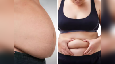 Weight Loss : डॉक्टरांनी सांगितला पोटाची ढेरी कायमची नाहीशी करणारा सर्वात सोपा उपाय, नष्ट होतात चरबीचे टायर्स