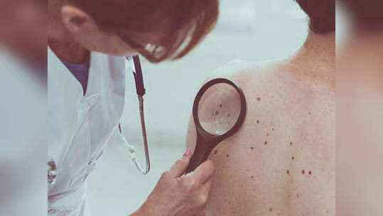 Skin Cancer Causes : சருமப் புற்றுநோய் வர இந்த 6 விஷயம்தான் காரணமாம்... 