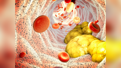 Cholesterol Reducing Foods: कोलेस्ट्रॉल को पानी बना देंगी ये 5 चीजें, नसों से खुद निकल जाएगी पीली गंदगी