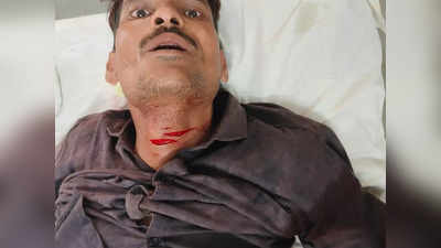 Hardoi News: हरदोई में पुलिस कस्टडी में युवक ने खुद की गर्दन काटी, अफसर घटना नकार रहे