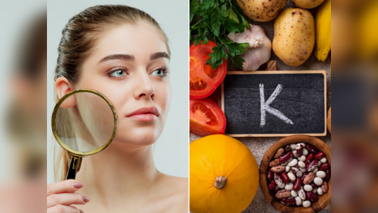 Vitamins for Skin Care: ડાયટમાં સામેલ કરો Vitamin K; ફરી ક્યારેય નહીં કરવી પડે કરચલીઓ, ડાઘ-ધબ્બાની ચિંતા 