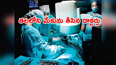 Doctors: తలలో 2 ఇంచుల మేకు.. 6 గంటలు ఆపరేషన్ చేసి తీసేసిన వైద్యులు 