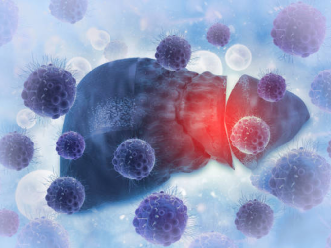 ​लिव्हर कॅन्सरची लक्षणे -Liver cancer Symptoms :​