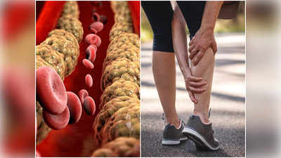 Cholesterol Symptoms In Leg: জানেন কি, পায়েও দেখা দিতে পারে কোলেস্টেরলের লক্ষণ? সাবধান না হলেই রোগ হবে আউট অব কন্ট্রোল