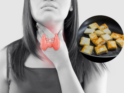 Foods Good For Thyroid: थायराइड को कंट्रोल रखता है आयोडीन, किसी भी कीमत पर खाएं ये 6 Iron Rich Foods